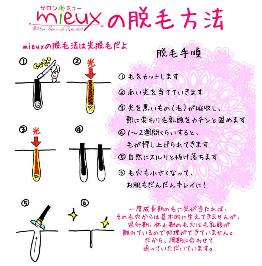 ミューの脱毛方法